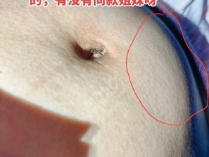 戳的肚子都鼓起来了 用什么东西戳的肚子都鼓起来了？