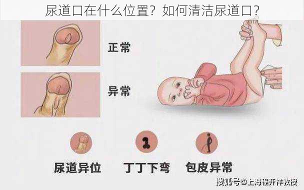 尿道口在什么位置？如何清洁尿道口？